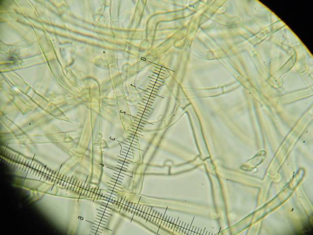 Amphinema byssoides? (Amphinema byssoides)